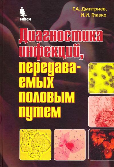 Книга: Диагностика инфекций, передаваемых половым путем (Дмитриев Георгий Александрович, Глазко Ирина Ивановна) ; Бином, 2007 