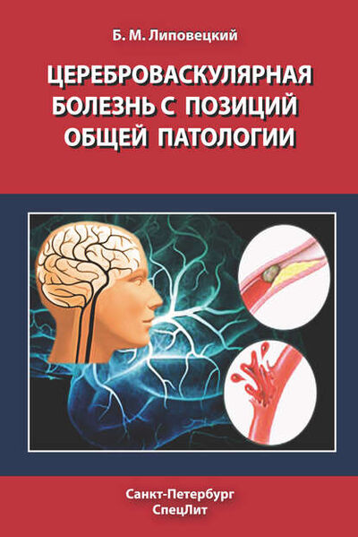 Книга: Цереброваскулярная болезнь с позиций общей патологии (Б. М. Липовецкий) ; СпецЛит, 2011 