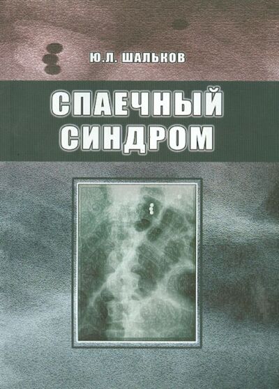 Книга: Спаечный синдром (Шальков Юлий Леонидович) ; Бином, 2011 