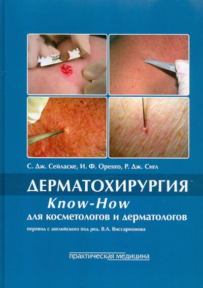 Книга: Дерматохирургия. Know-How для косметологов и дерматологов. (Сейласке Стьюарт Дж., Оренго Ида Ф., Сигл Роналд Дж.) ; Практическая медицина, 2009 