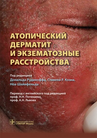 Книга: Атопический дерматит и экзематозные расстройства (Рудикофф Дональд, Коэн Стивен Р., Шайнфельд Ноа) ; ГЭОТАР-Медиа, 2017 