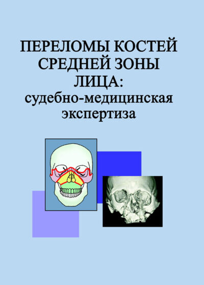 Книга: Переломы костей средней зоны лица: судебно-медицинская экспертиза (Л. Н. Гришенкова) ; Вышэйшая школа, 2015 