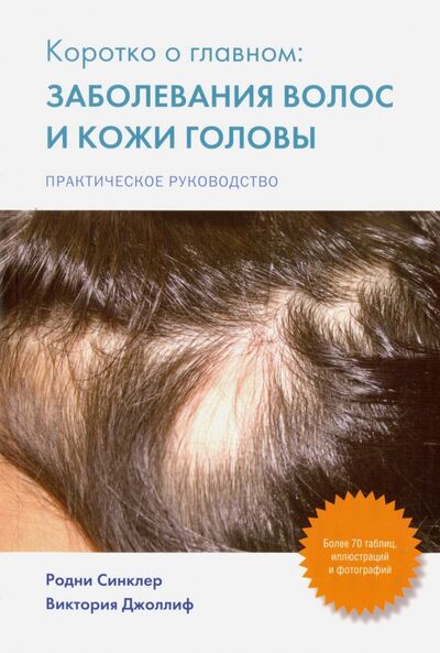 Книга: Коротко о главном. Заболевание волос и кожи головы (Синклер Родни, Джоллиф Виктория) ; Издательство Панфилова, 2014 