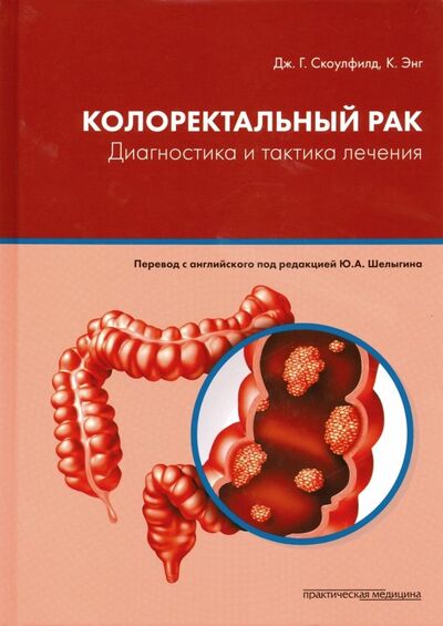 Книга: Колоректальный рак. Диагностика и тактика лечения (Скоулфилд Дж. Г., Энг К.) ; Практическая медицина, 2019 