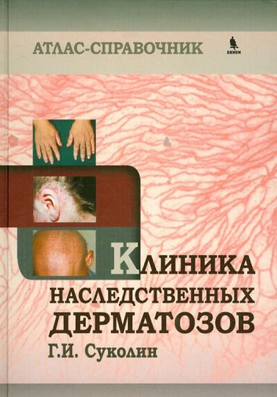 Книга: Клиника наследственных дерматозов. Атлас-справочник (Суколин Геннадий Иванович) ; Бином, 2014 