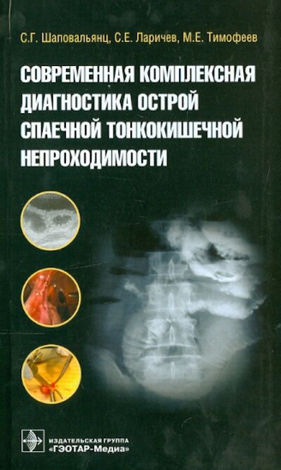 Книга: Современная комплексная диагностика острой спаечной тонкокишечной непроходимости (Шаповальянц С. Г., Ларичев С. Е., Тимофеев М. Е.) ; ГЭОТАР-Медиа, 2014 
