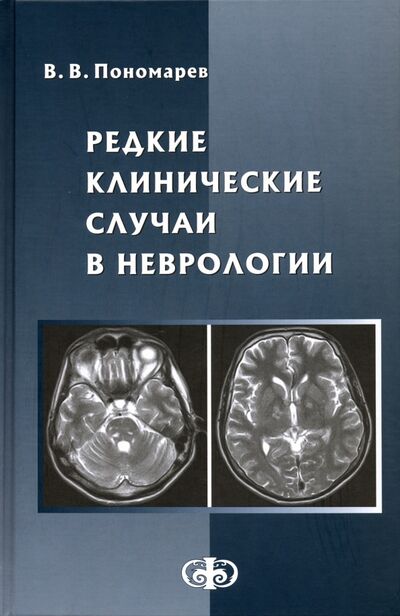 Книга: Редкие клинические случаи в неврологии (случаи из практики). Руководство для врачей (Пономарев Владимир Владимирович) ; Фолиант (мед.), 2020 