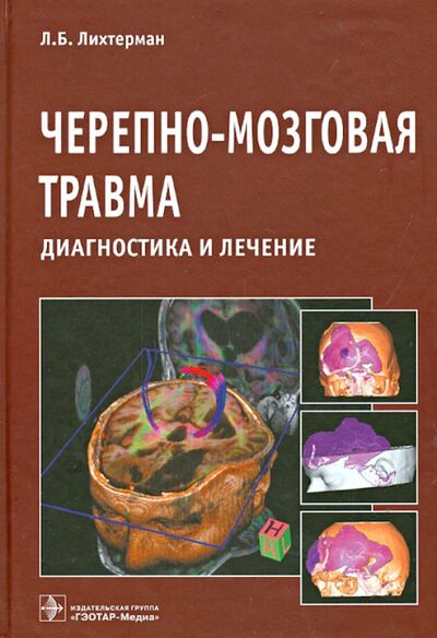 Книга: Черепно-мозговая травма. Диагностика и лечение (Лихтерман Леонид Бориславович) ; ГЭОТАР-Медиа, 2014 