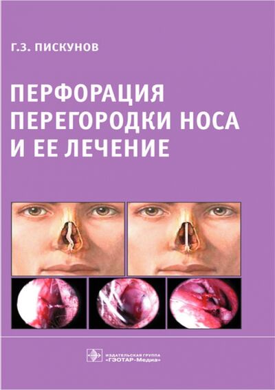 Книга: Перфорация перегородки носа и ее лечение (Пискунов Геннадий Захарович) ; ГЭОТАР-Медиа, 2016 