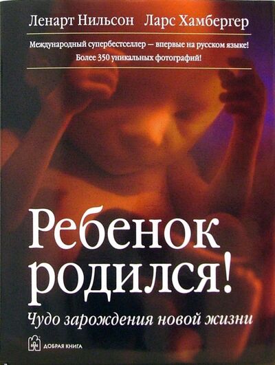 Книга: Ребенок родился! Чудо зарождения новой жизни (Нильсон Ленарт, Хамбергер Ларс) ; Добрая книга, 2007 