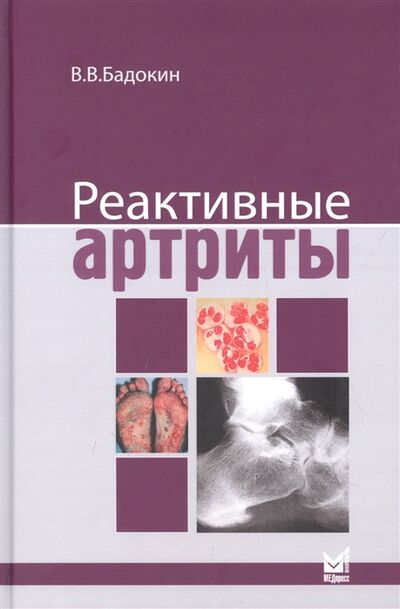 Книга: Реактивные артриты (Бадокин Владимир Васильевич) ; МЕДпресс-информ, 2021 